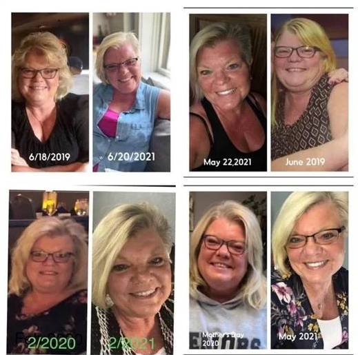 59 year old female, wanted to lose weight, Terre Haute, IN Before