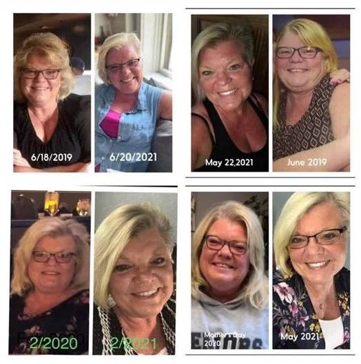 59 year old female, wanted to lose weight, Terre Haute, IN Before