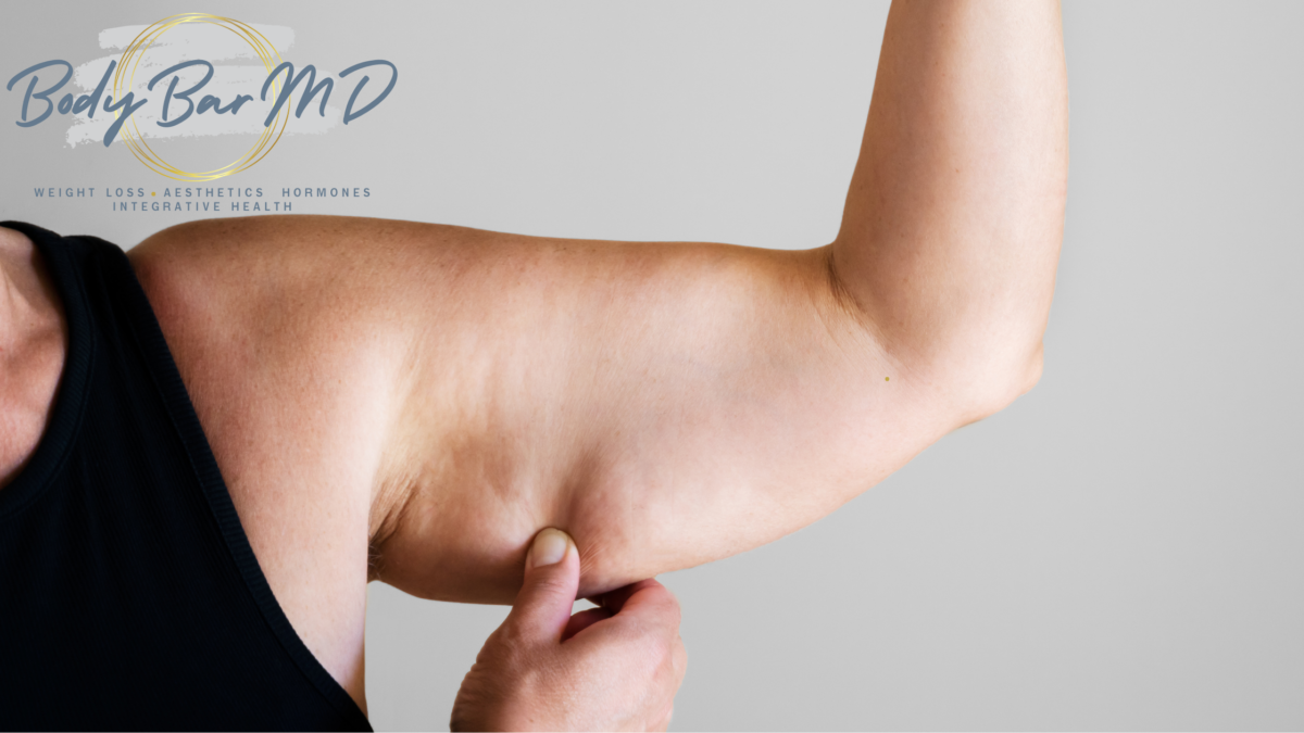 Person holding arm with loose skin, considering laser liposuction with fat transfer at Body Bar MD