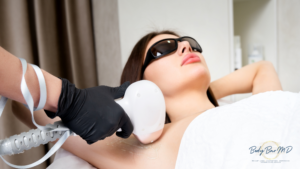 A woman receiving laser hair removal treatment on her underarm, wearing protective glasses, performed by a professional.