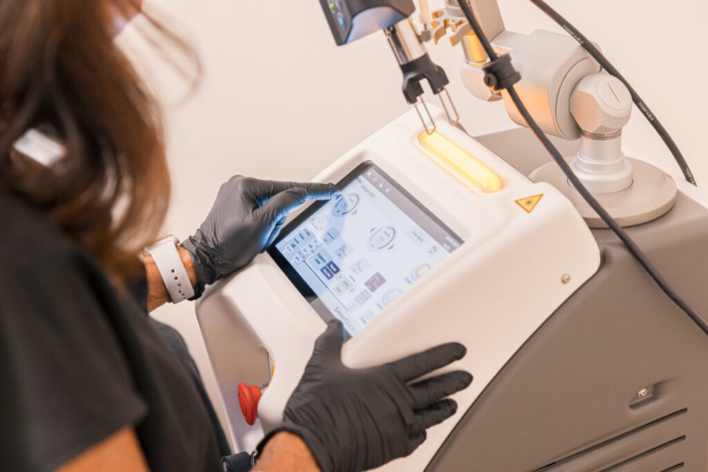 A provider with gloves prepares laser treatment for sun spots in Carmel, IN