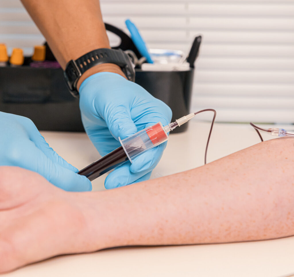 A provider makes a blood draw before a PRP facial near Indianapolis.