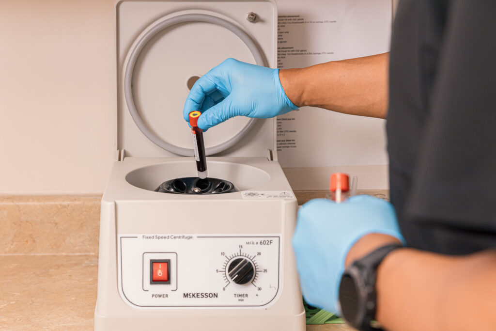 A gloved provider prepares a Vampire Facial near Indianapolis